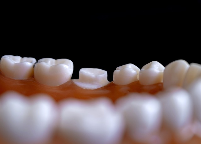 Kodėl verta rinktis profesionalią odontologijos kliniką savo dantų priežiūrai?